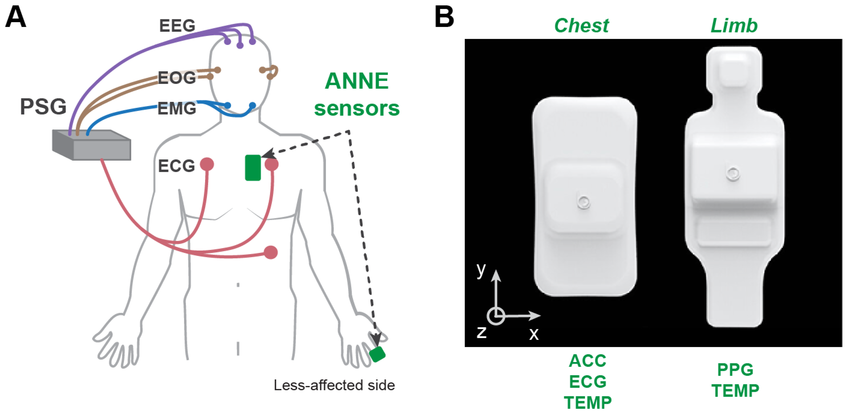 Sleep Trackers With ECG