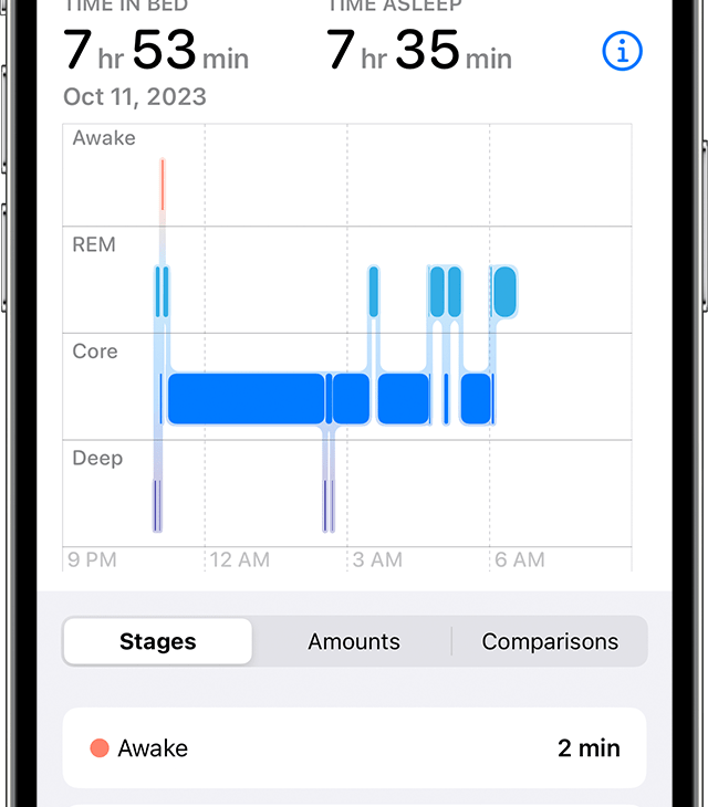 Sleep Trackers With Sleep History Reports
